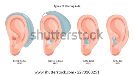 Hearing aids types set. Neuroprosthesis to a deaf person. Hearing loss assistance with electrical stimulation of the auditory nerve. Flat vector illustration