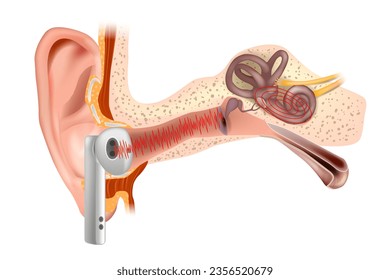 Hearing damage. Loud sound from vacuum headphones damage the inner ear. Inner ear Hearing loss.  