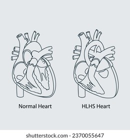 Heart Anatomie, Vektorgrafik, Vektorgrafik 2D Illustration