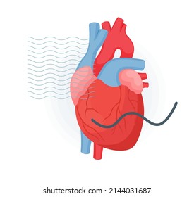 Ataque cardíaco con símbolo ECG Icono material como archivo EPS 10