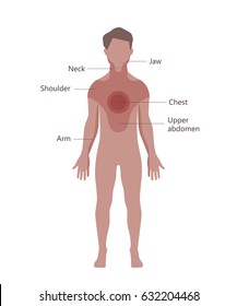 Heart attack pain location. Vector illustration flat design