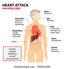 Heart Attack Signs and Symptoms. Human silhouette with highlighted internal organs. warning sign