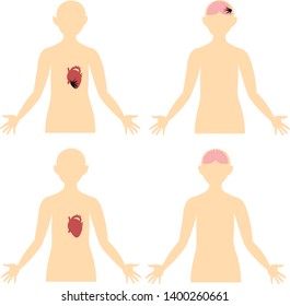 Heart attack, stroke, thrombosis. Diseases of the brain and heart. Anatomy. Scheme of the human body.

