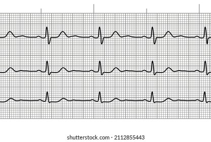 Heart beat ecg or ekg seamless line on black and white paper. Electrocardiogram graph of healsh cardio rate. Examination of human health. Medicine test cardiac rhythm and pulsating inteval.