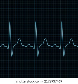 Heart beat ecg or ekg seamless neon line on blue background. Electrocardiogram graph of healsh cardio rate. Examination of human health. Medicine test cardiac rhythm and pulsating inteval.