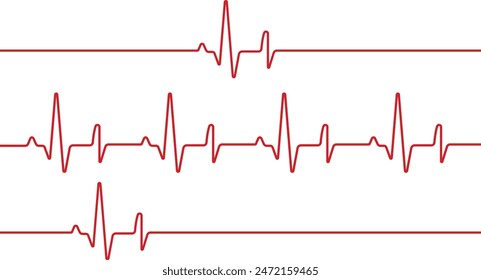 Herzschlag auf der EKG-Vektorgrafik