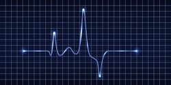 Heart Beat Pulse Monitor, Blue Electric Wave Signal, Oscilloscope Graph. Electrocardiogram Line Graph With Light Glow Effect. Technology VVector Illustration