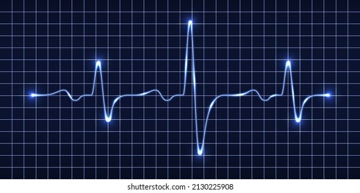 Heart beat pulse monitor; blue electric wave signal; oscilloscope graph. Electrocardiogram line graph with light glow effect. Technology vVector illustration