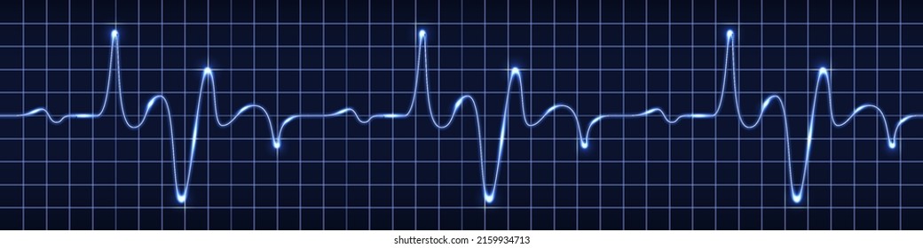 Monitor de pulso de latido cardíaco, señal de onda eléctrica azul, osciloscopio gráfico. Gráfico de líneas electrocardiográficas con efecto de brillo claro. Ilustración de vVector de tecnología