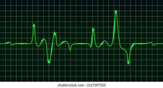 Heart beat pulse monitor, green electric wave signal, oscilloscope graph. Electrocardiogram line graph with light glow effect. Technology vVector illustration
