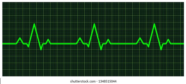 Heart beats cardiogram - Vector - Vektör