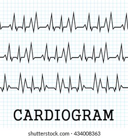 Heart beats cardiogram - Vector