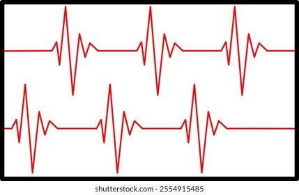 heart bit rate monitoring on white background, medical check heart with EKG, ECG tools measurement. result medical lab