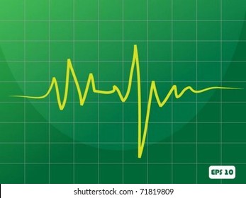 Heart cardiogram