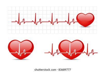 Heart cardiogram