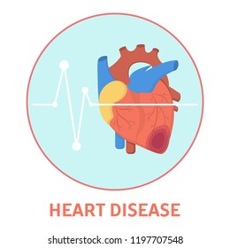 Heart disease concept. Heart attack or coronary disease, infarction or ischemia. Problems with health and blood pressure. Healthcare and treatment in hospital. Isolated flat vector illustration