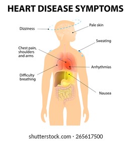 Heart Disease. Signs And Symptoms. Coronary Artery Disease, Or Ischemic Heart Disease. Also Known As Atherosclerotic Heart Disease Or Atherosclerotic Cardiovascular Disease And Coronary Heart Disease