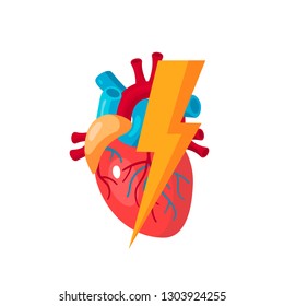 Heart diseases concept. Vector illustration for medical articles, education textbooks, web banners etc. in flat style