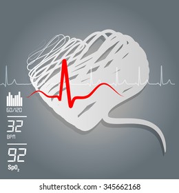 Heart ECG Abstract