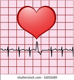 heart ekg