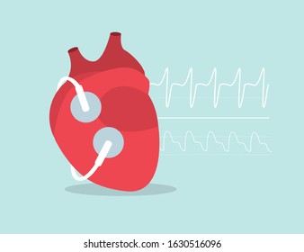 Heart electrodes. Check heart beating with ECG. Heart rate monitor. Medical electronics. Flat vector illustration
