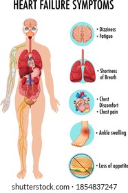 Heart Failure Symptoms Information Infographic Illustration