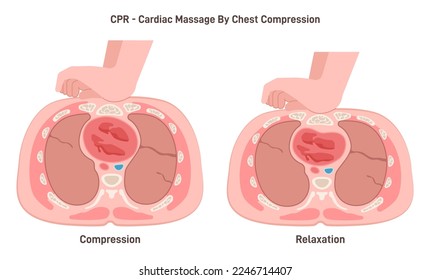 Heart massage or first aid cardiopulmonary resuscitation, chest compression cross section view. Training or educational illustration. Flat vector illustration