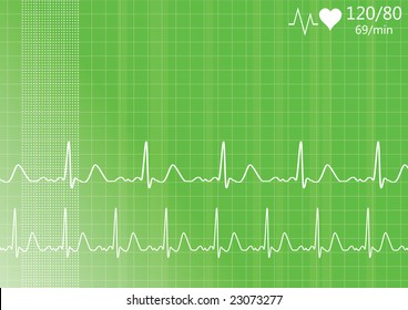 Heart monitor. Vector.