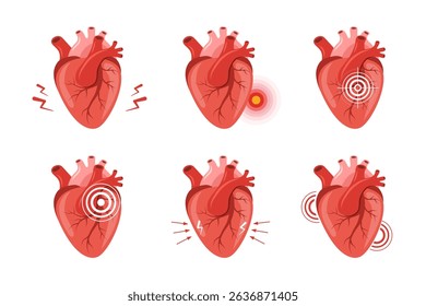 Heart pain. Human internal organ disease. Heart medical diagnosis and treatment. Set of Vector illustrations in flat cartoon style.