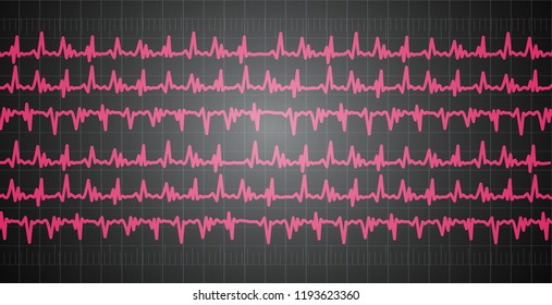 Heart pulse graphic. Vector illustration, eps 10.