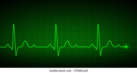 Heart pulse graphic. Vector illustration.