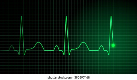 Heart pulse on green screen