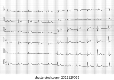 Cardiograma de frecuencia cardíaca. Latido. Corazón médico.