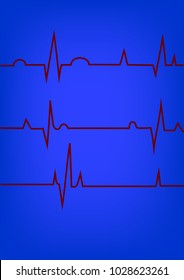 Heart rate graphic. Vector illustration. (Electrocardiogram or ECG) set