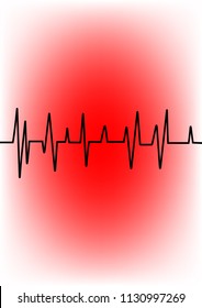 
Heart rate graphic. Vector illustration. (Electrocardiogram or ECG)