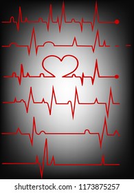 Heart rate graphic. Vector illustration. (Electrocardiogram or ECG) set