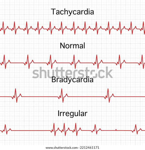 Heart Rate Graphics Vector Illustration Electrocardiogram Stock Vector ...