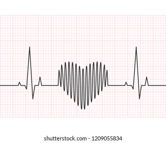 Heart rate line with grid in the background. Heartbeat, pulse and rythm, electrocardiogram and ECG concept. Vector illustration.