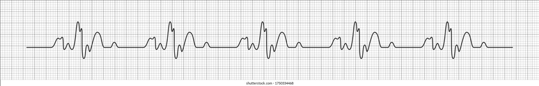 Heart rhytm. Electrocardiogram. Heartbeat. Heartbeat line. Vector illustration.