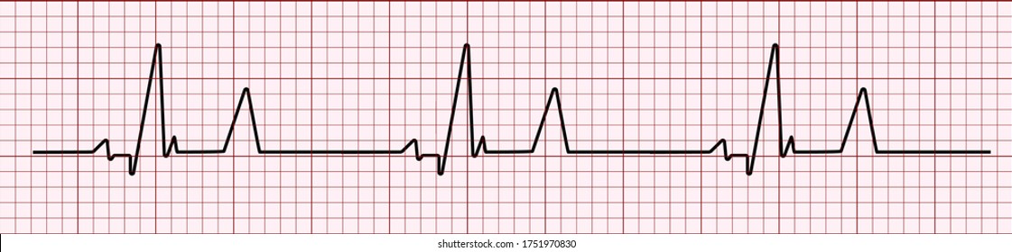 Heart rhytm. Electrocardiogram. Heartbeat. Heartbeat line. Vector illustration.