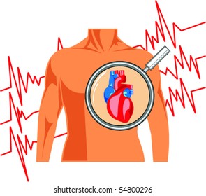Heart surveillance