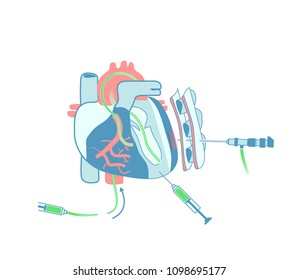 heart tissue grafting injection mesh