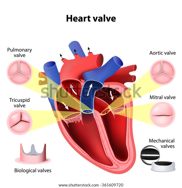 Heart valve\
surgery. Pulmonary, Tricuspid, Aortic and Mitral valve. Biological\
valves and Mechanical\
valves