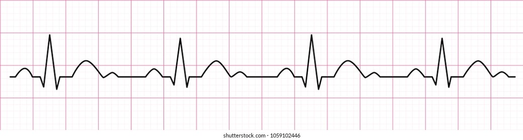 Heartbeat line. Cardiogram. Electrocardiogram. Vector illustration.