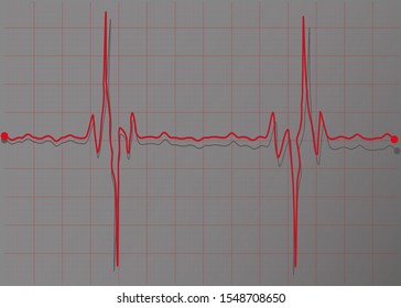 Heartbeat line. Cardiogram. Electrocardiogram. Vector illustration.