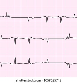 Heartbeat vector illustration