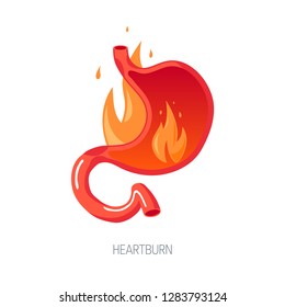 Heartburn Concept. Human Stomach On Fire, Cut View. Vector Illustration In Flat Style.