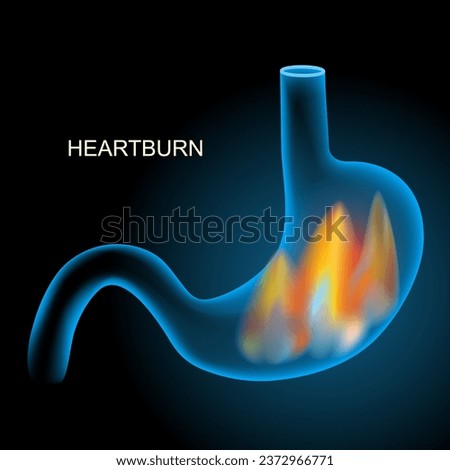 Heartburn. Pyrosis, cardialgia or acid indigestion. burning sensation in the stomach. Gastroesophageal reflux disease GERD. Blue realistic stomach with flame on dark background. vector X-ray image