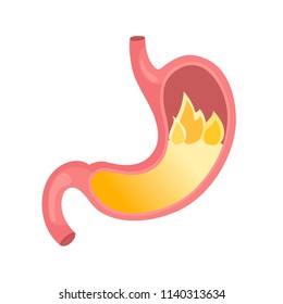 Heartburn. Stomach. Diseases of the stomach. Flat illustration
