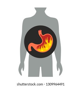 heartburn in the stomach. flat vector illustration isolated on white background 